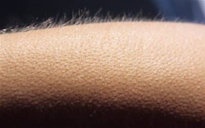 Frisson